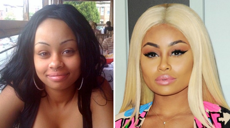 blac chyna before and after